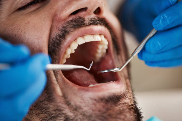 Sedation Dentistry in Lakeshire, MO